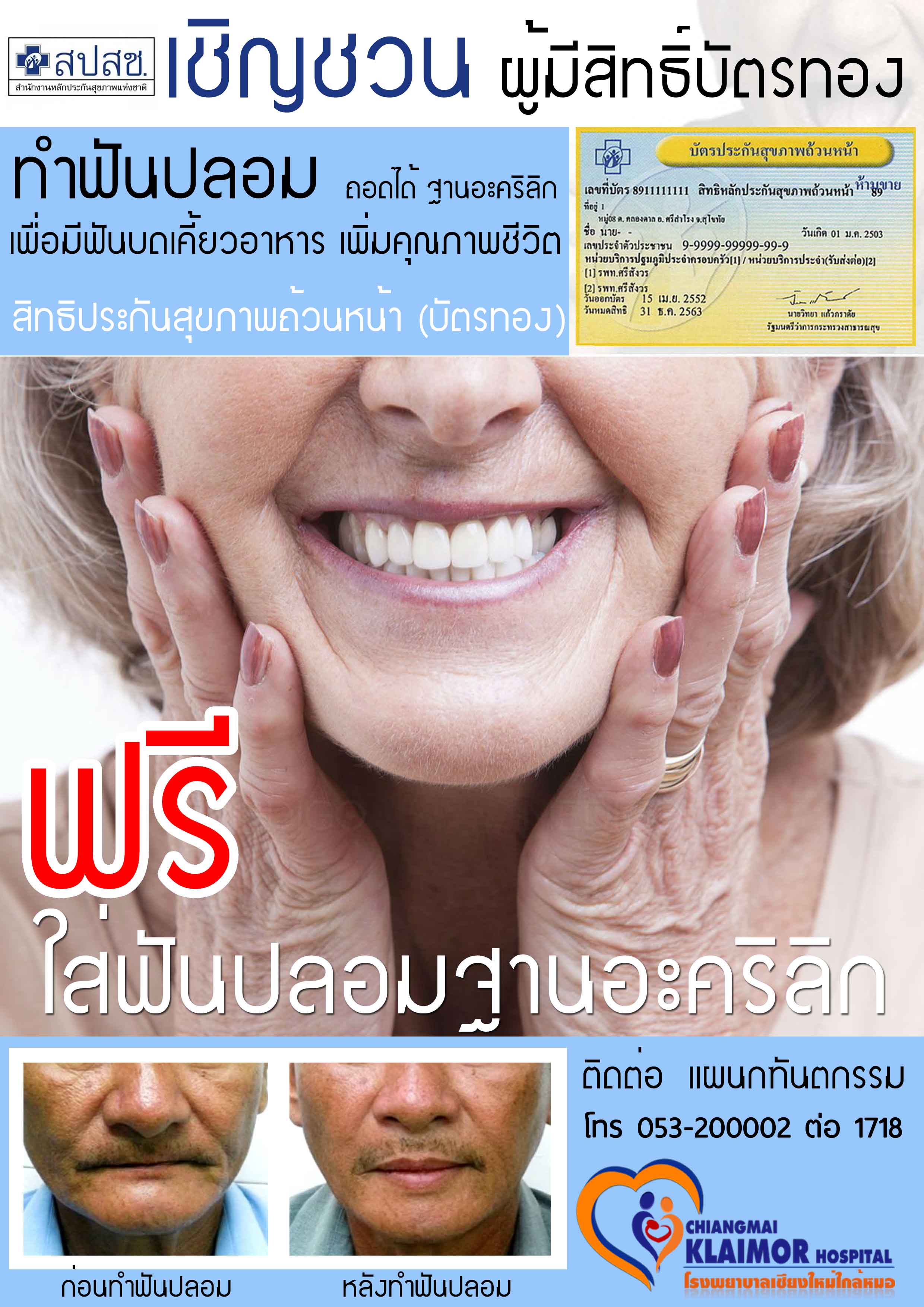 ฟันปลอม.jpg (387 KB)